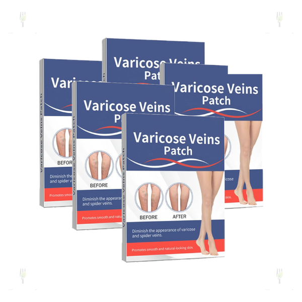 Varicose